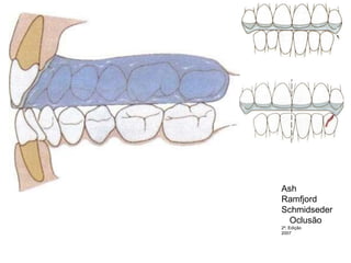 Ash RamfjordSchmidsederOclusão 2ª. Edição 2007