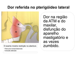 Dor referida no pterigóideo lateral