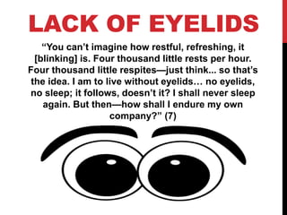 LACK OF EYELIDS 
“You can’t imagine how restful, refreshing, it 
[blinking] is. Four thousand little rests per hour. 
Four thousand little respites—just think... so that’s 
the idea. I am to live without eyelids… no eyelids, 
no sleep; it follows, doesn’t it? I shall never sleep 
again. But then—how shall I endure my own 
company?” (7) 
 