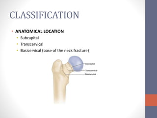 Basicervical neck of femur fracture | PPTX
