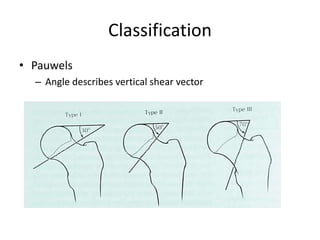 Classification
• Pauwels
– Angle describes vertical shear vector
 