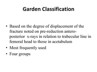 Garden Classification
• Based on the degree of displacement of the
fracture noted on pre-reduction antero-
posterior x-rays in relation to trabecular line in
femoral head to those in acetabulum
• Most frequently used
• Four groups
 
