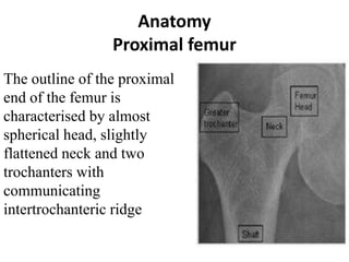 Anatomy
Proximal femur
The outline of the proximal
end of the femur is
characterised by almost
spherical head, slightly
flattened neck and two
trochanters with
communicating
intertrochanteric ridge
 