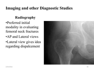 Imaging and other Diagnostic Studies
Radiography
•Preferred initial
modality in evaluating
femoral neck fractures
•AP and Lateral views
•Lateral view gives idea
regarding dispalcement
2/24/2016 40
 