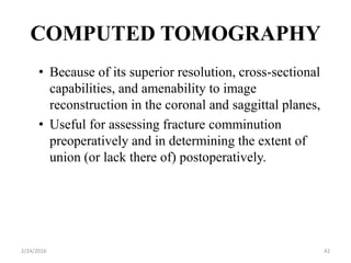 COMPUTED TOMOGRAPHY
2/24/2016 42
• Because of its superior resolution, cross-sectional
capabilities, and amenability to image
reconstruction in the coronal and saggittal planes,
• Useful for assessing fracture comminution
preoperatively and in determining the extent of
union (or lack there of) postoperatively.
 