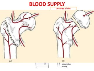 BLOOD SUPPLY
Extracapsular arterial
ring
Arteries of the
ligamentum teres
Retinacular arteries
 