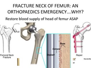 FRACTURE NECK OF FEMUR: AN
ORTHOPAEDICS EMERGENCY….WHY?
Restore blood supply of head of femur ASAP
 