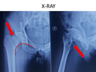 X-RAY
 