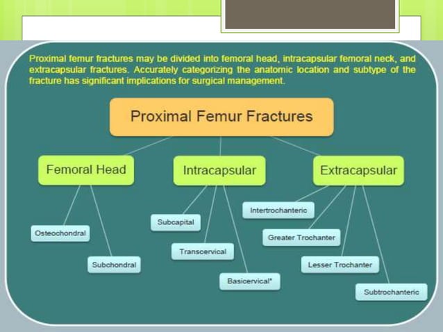 Nof fracture