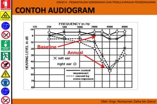 Noise Module 2 - Audiometry | PPTX