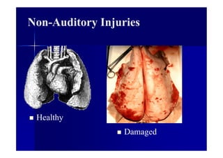 Non-Auditory Injuries
 Healthy
 Damaged
 