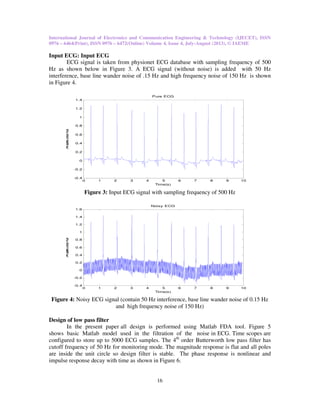 Noise reduction in ecg by iir filters a comparative study | PDF