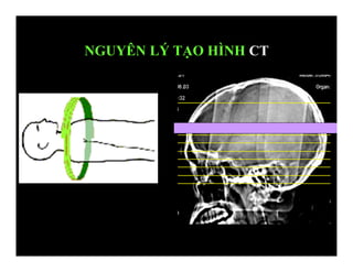 NGUYÊN LÝ TẠO HÌNH CT
 