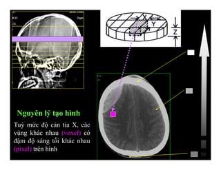 Nguyên lý tạo hình
Tuỳ mức độ cản tia X, các
vùng khác nhau (voxel) có
đậm độ sáng tối khác nhau
(pixel) trên hình
 