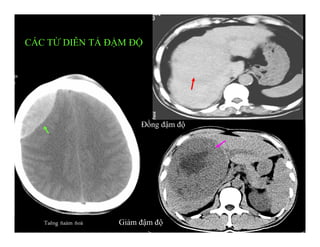 Giảm đậm độTaêng ñaäm ñoä
Đồng đậm độ
CÁC TỪ DIỄN TẢ ĐẬM ĐỘ
 