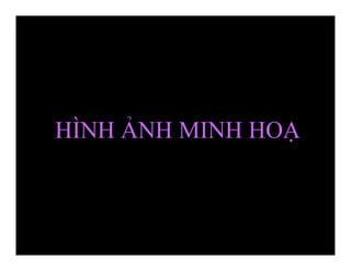 HÌNH ẢNH MINH HOẠ
 