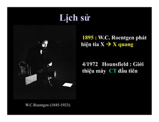 1895 : W.C. Roentgen phát
hiện tia X  X quang
Lịch sử
W.C.Roentgen (1845-1923)
4/1972 Hounsfield : Giới
thiệu máy CT đầu tiên
 