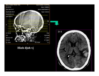 I# 8
8
Hình định vị
 