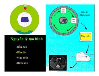 Nguyên lý tạo hình
-Đầu đèn
-Đầu dò
-Máy tính
-Hình ảnh
Máy tính
Đầu dò
(Detectors)
Đầu
đèn
Đầu
đèn
 
