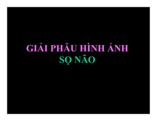 GIẢI PHẪU HÌNH ẢNH
SỌ NÃO
 