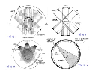 Thế hệ I
Thế hệ II
Thế hệ III
Thế hệ IV
 