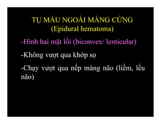 -Hình hai mặt lồi (biconvex/ lenticular)
-Không vượt qua khớp sọ
-Chạy vượt qua nếp màng não (liềm, lều
não)
TỤ MÁU NGOÀI MÀNG CỨNG
(Epidural hematoma)
 