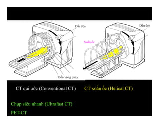 CT xoắn ốc (Helical CT)CT qui ước (Conventional CT)
Đầu đèn Đầu đèn
Bốn vòng quay
Xoắn ốc
Chụp siêu nhanh (Ultrafast CT)
PET-CT
 