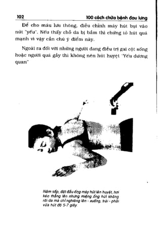 100 CÁCH CHỮA  BỆNH ĐAU LƯNG