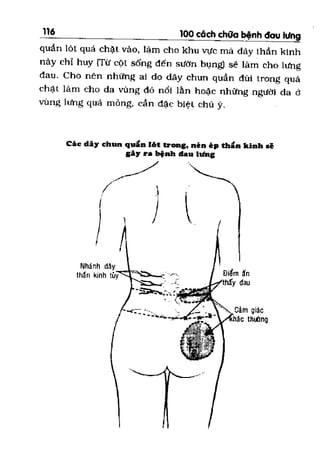 100 CÁCH CHỮA  BỆNH ĐAU LƯNG