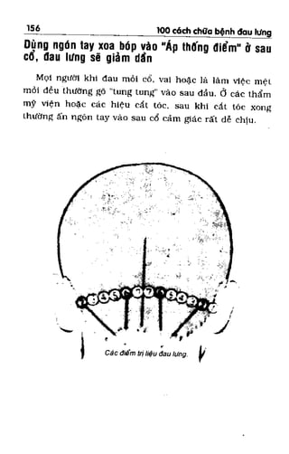100 CÁCH CHỮA  BỆNH ĐAU LƯNG