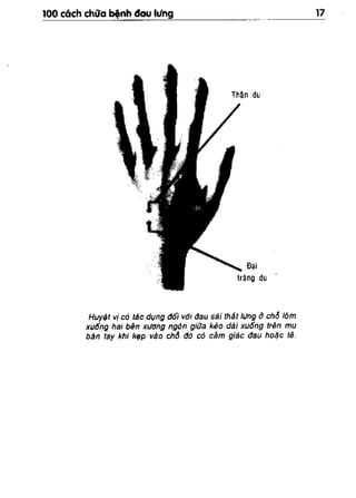 100 CÁCH CHỮA  BỆNH ĐAU LƯNG
