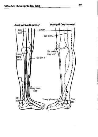100 CÁCH CHỮA  BỆNH ĐAU LƯNG