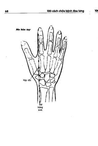 100 CÁCH CHỮA  BỆNH ĐAU LƯNG