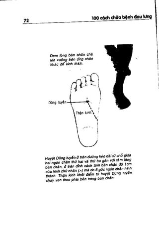 100 CÁCH CHỮA  BỆNH ĐAU LƯNG