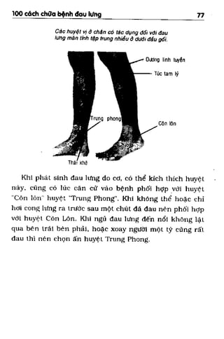 100 CÁCH CHỮA  BỆNH ĐAU LƯNG