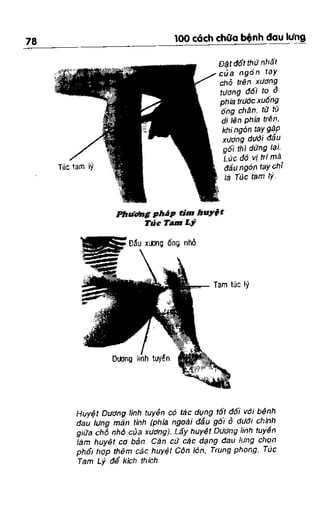 100 CÁCH CHỮA  BỆNH ĐAU LƯNG
