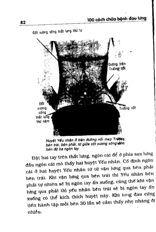 100 CÁCH CHỮA  BỆNH ĐAU LƯNG