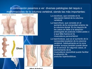 A continuación pasamos a ver diversas patologías del raquis o
malformaciones de la columna vertebral, siendo las más importantes:
                                     La escoliosis, que consiste en la
                                         desviación lateral de la columna
                                         vertebral.
                                     La hipercifosis, que consiste en el
                                         aumento de la concavidad anterior de
                                         la columna dorsal. En la mayoría de
                                         los casos se debe a la adopción
                                         prolongada de posturas inadecuadas o
                                         a que falta fuerza en la
                                         musculatura paravertebral.
                                     La hiperlordosis, que es el aumento de la
                                         concavidad posterior de la columna
                                         vertebral, habitualmente en la zona
                                         lumbar aunque también puede darse
                                         en la cervical. En algunos casos, el
                                         acortamiento de la
                                         musculatura isquiotibial puede facilitar
                                         la adopción de
                                         posturas hiperlordóticas.
 