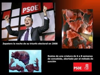 Zapatero la noche de su triunfo electoral en 2008 Restos de una criatura de 6 a 8 semanas de concebida, abortada por el método de succión  