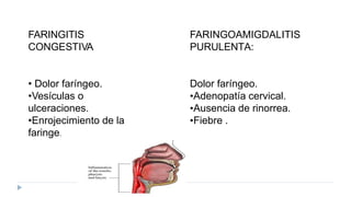 FARINGITIS
CONGESTIVA
• Dolor faríngeo.
•Vesículas o
ulceraciones.
•Enrojecimiento de la
faringe.
FARINGOAMIGDALITIS
PURULENTA:
Dolor faríngeo.
•Adenopatía cervical.
•Ausencia de rinorrea.
•Fiebre .
 