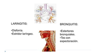 LARINGITIS:
•Disfonía.
•Estridor laríngeo.
BRONQUITIS:
•Estertores
bronquiales.
•Tos con
expectoración.
 