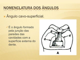 NOMENCLATURA DOS ÂNGULOS

   Ângulo cavo-superficial.


    É o ângulo formado
     pela junção das
     paredes das
     cavidades com a
     superfície externa do
     dente.
 