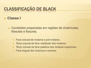 CLASSIFICAÇÃO DE BLACK
   Classe I

       Cavidades preparadas em regiões de cicatrículas,
        fóssulas e fissuras.

           Face oclusal de molares e pré-molares.
           Terço oclusal da face vestibular dos molares.
           Terço oclusal da face palatina dos molares superiores.
           Face lingual dos incisivos e caninos.
 