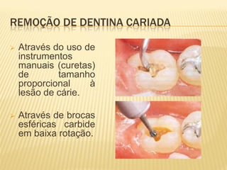 REMOÇÃO DE DENTINA CARIADA

   Através do uso de
    instrumentos
    manuais (curetas)
    de       tamanho
    proporcional    à
    lesão de cárie.

   Através de brocas
    esféricas carbide
    em baixa rotação.
 