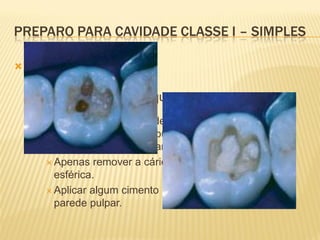 PREPARO PARA CAVIDADE CLASSE I – SIMPLES

   Forma de Retenção

     Profundidade   maior que a largura da cavidade
       Onde   há a presença de pontos de cáries mais
        profundos na parede pulpar, não há a necessidade
        de aprofundar englobando o tecido cariado.
       Apenas remover a cárie mais profunda com broca
        esférica.
       Aplicar algum cimento para o aplainamento da
        parede pulpar.
 