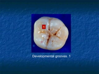 1




Developmental grooves. 1
 