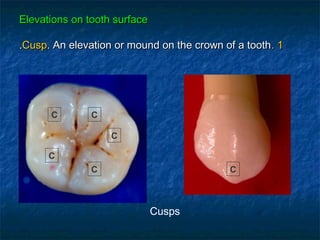 Elevations on tooth surface

.Cusp. An elevation or mound on the crown of a tooth. 1




      C        C

                   C

      C
               C                           C



                              Cusps
 