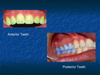 Anterior Teeth




                 Posterior Teeth
 