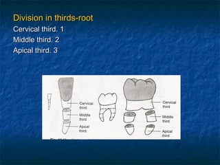 Division in thirds-root
Cervical third. 1
Middle third. 2
Apical third. 3
 