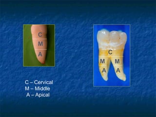 C
     M
     A             C
               M       M
               A       A
C – Cervical
M – Middle
A – Apical
 